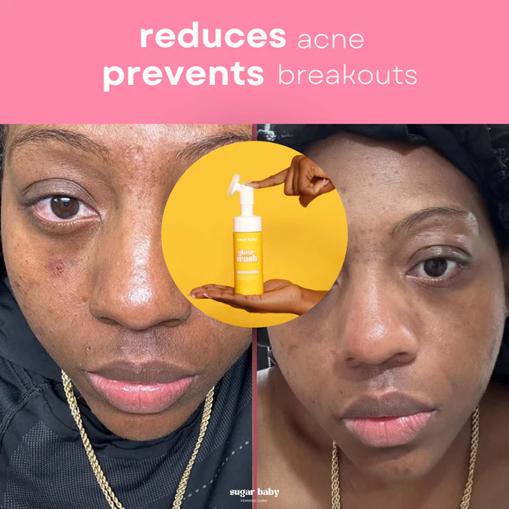 Turmeric & Kojic Acid Wash