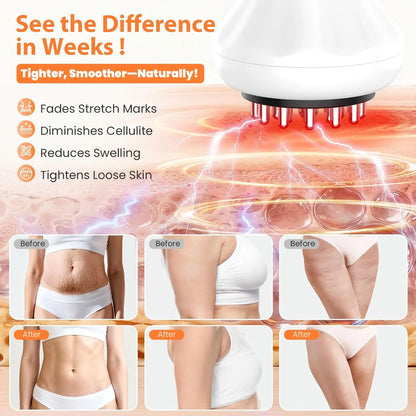 NEW: 2026's Top-Rated Lymphatic Detox Sculptor