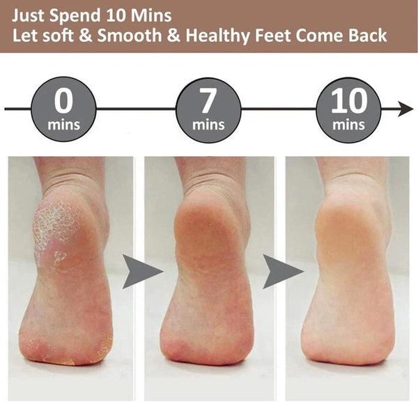 Smooth Steps Foot Care Kit