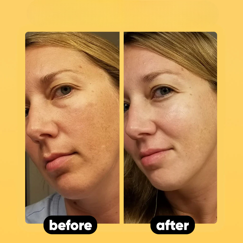 Scentra Glow Soap With Turmeric + Kojic Acid™