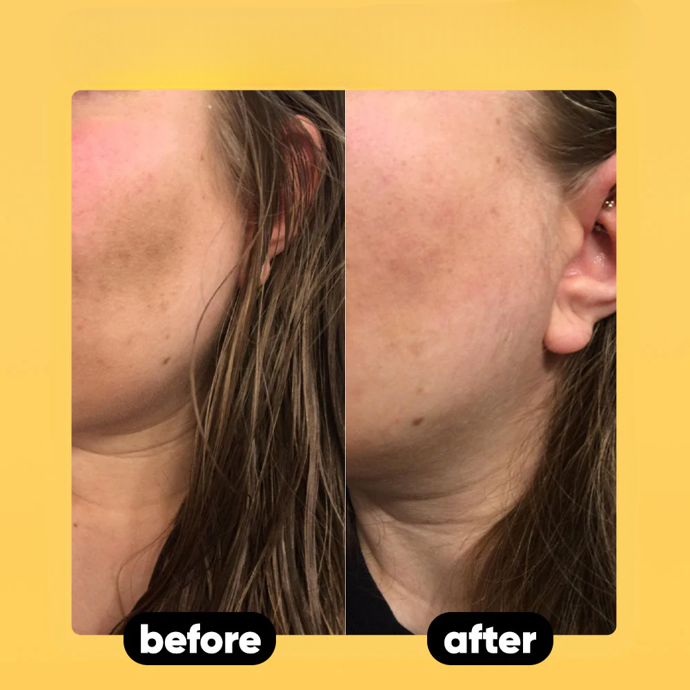 Scentra Glow Soap With Turmeric + Kojic Acid™