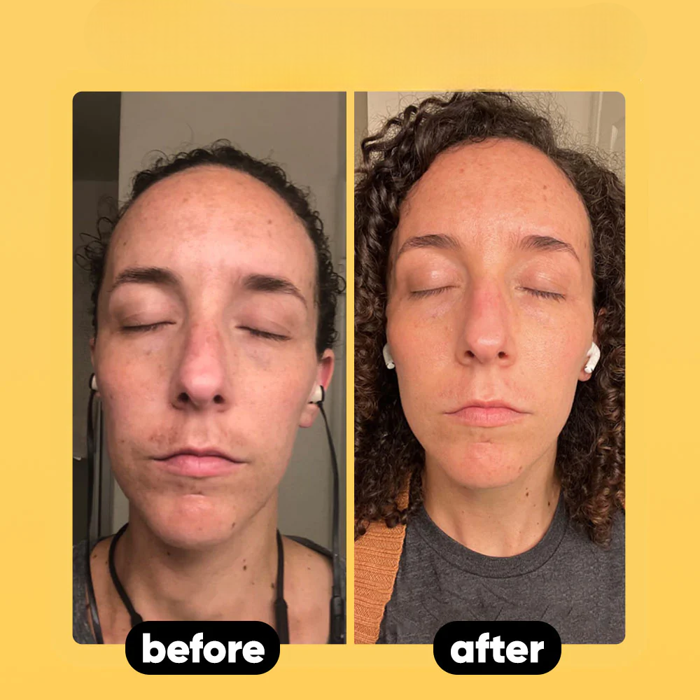 Scentra Glow Soap With Turmeric + Kojic Acid™